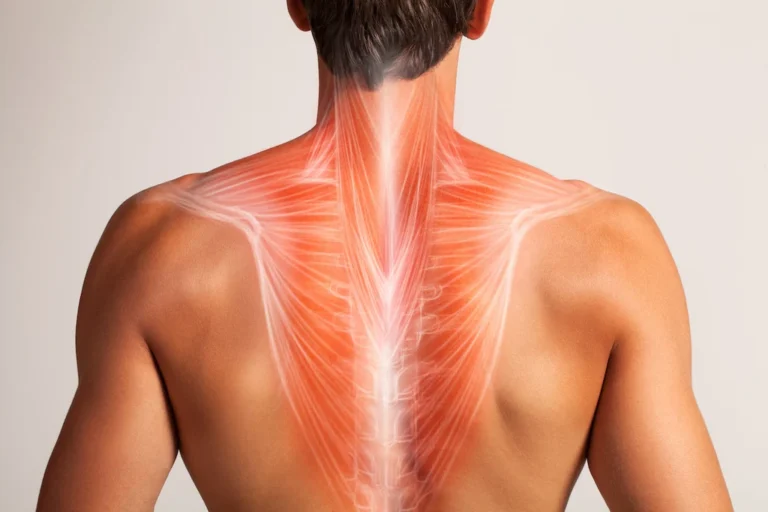 Relieve Upper Back Pain and Restore Mobility with Targeted Treatment